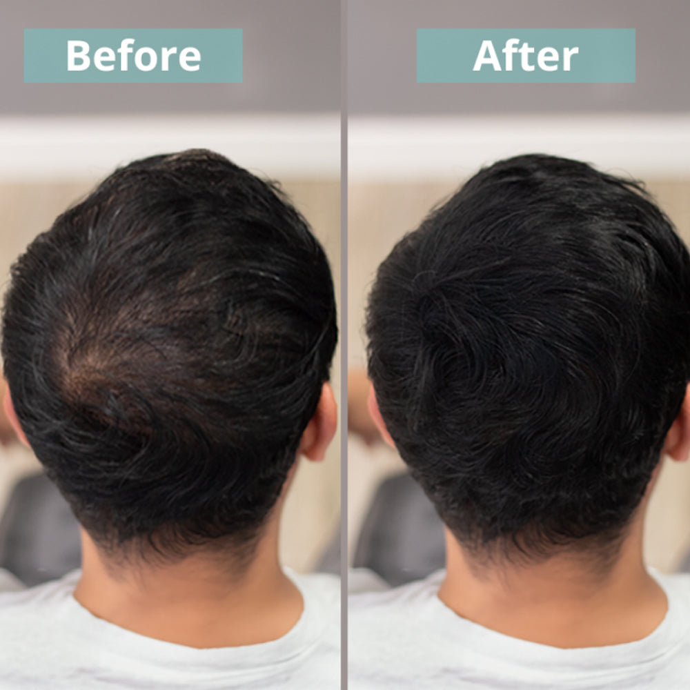 Кератиновые волокна 12.5г - The Cosmetic Republic Keratin Fibers